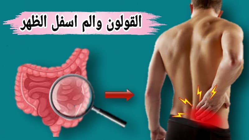 هل القولون يسبب ألم في الظهر ؟