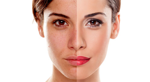 5 أخطاء يومية بتدمر بشرتك.. تجنبيها فورًا