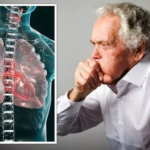 متى تصبح أمراض الرئة خطرًا يهدد الحياة ؟