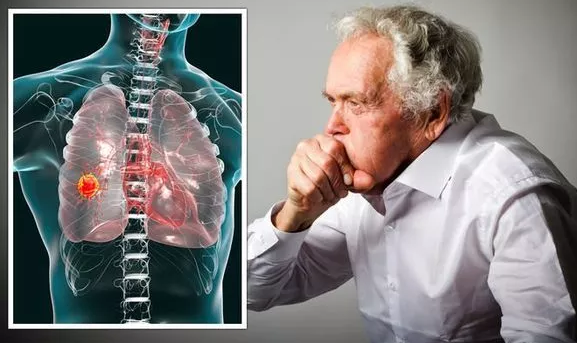 متى تصبح أمراض الرئة خطرًا يهدد الحياة ؟