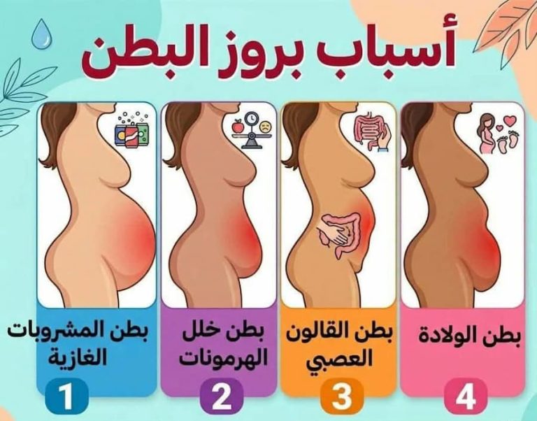 12 سببًا لبروز البطن عند النساء .. تعرف على العلاج المناسب