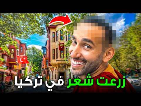 زراعة الشعر في تركيا و أماكن سياحة سرية 2026