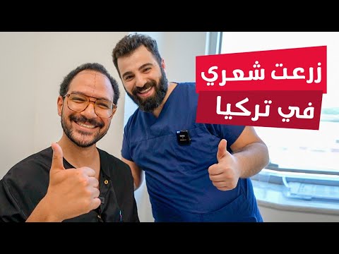 تجربتي في زراعة الشعر في تركيا 2026